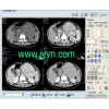 CT医学影像工作站