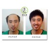 石家庄哪里有卖好用的织发|清苑织发