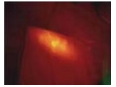 HXDT-2手电筒双波段激光物证发现仪图2