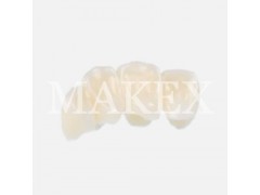 数字化齿科专用蜡冠临时牙冠3D打印机图3